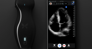 Ternyata iPhone Dan Aksesori Butterfly IQ Bisa Deteksi Kanker Di Dalam Tubuh
